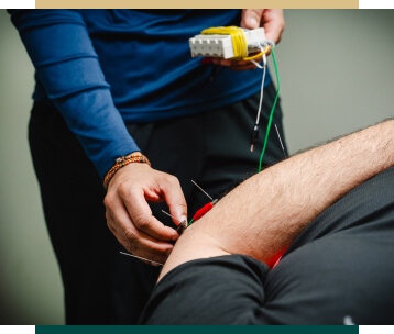 Acupuncture